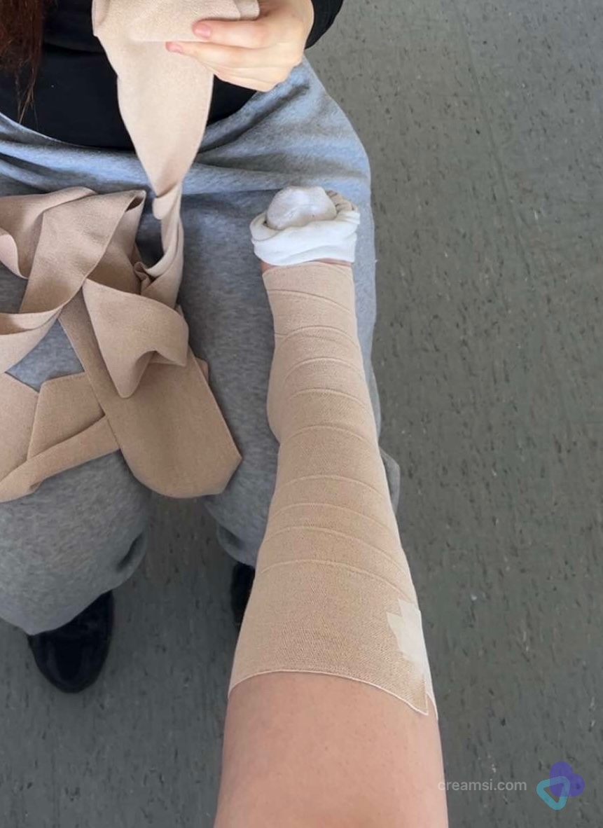 Beige Bandage bein und fuß